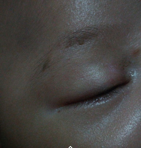 bisa tumbuh lagi?