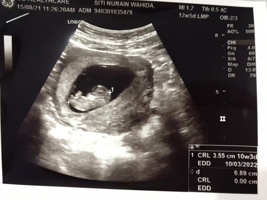 Aien Wahida profile icon