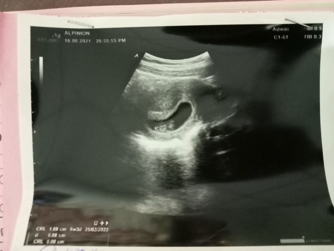 Mo Padcharida profile icon