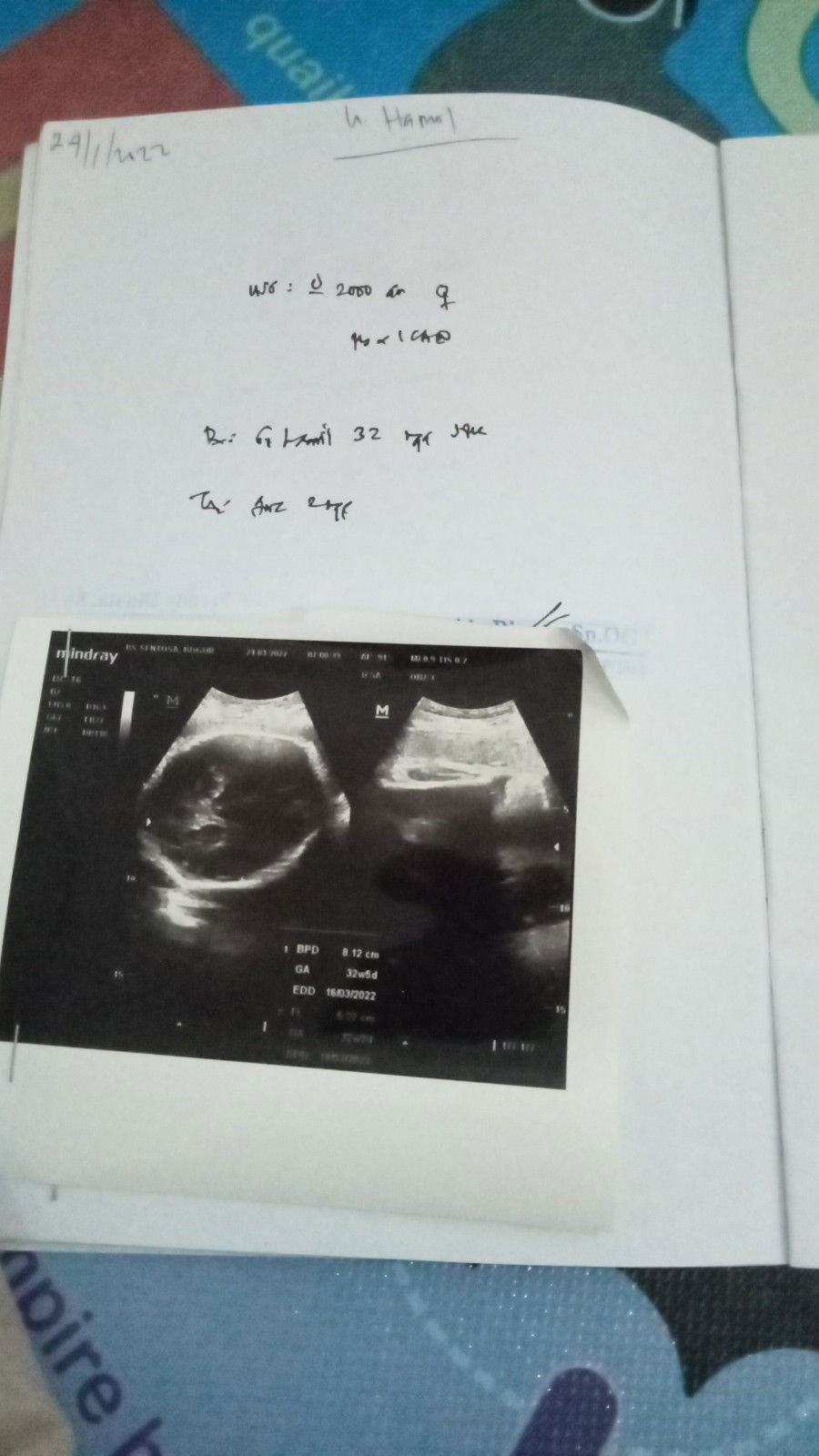 indah dwi yusni putri profile icon