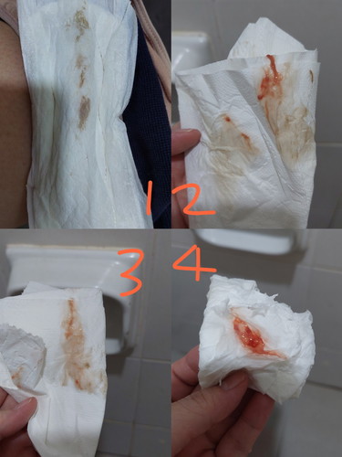 Dah kena pergi hospital ke?