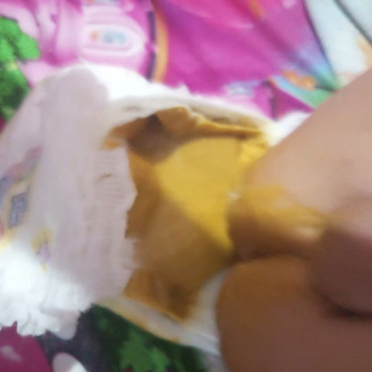 mohon maaf pup seperti in wajarkah?