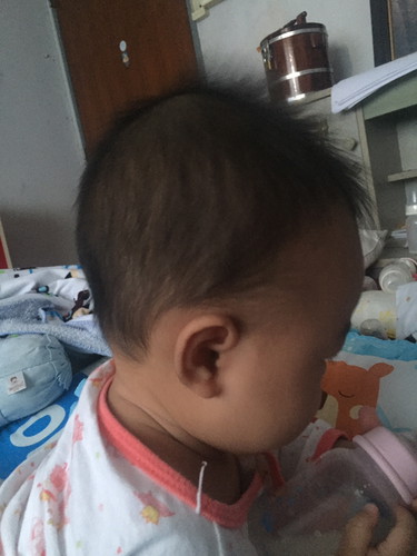 แบบนี้หัวแบนไหมค่ะ