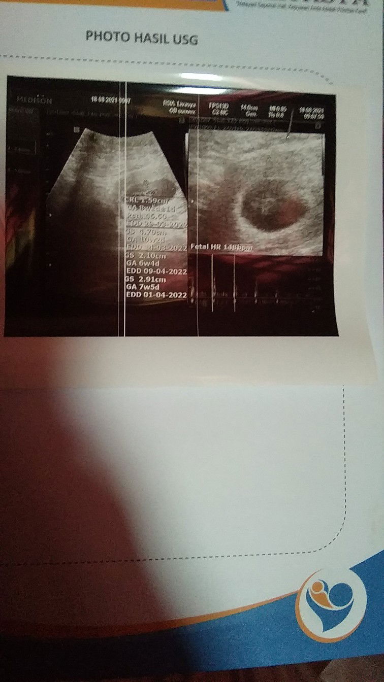 Ilan Haelani profile icon