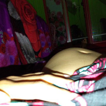 perut kencang dan benjol ke kiri