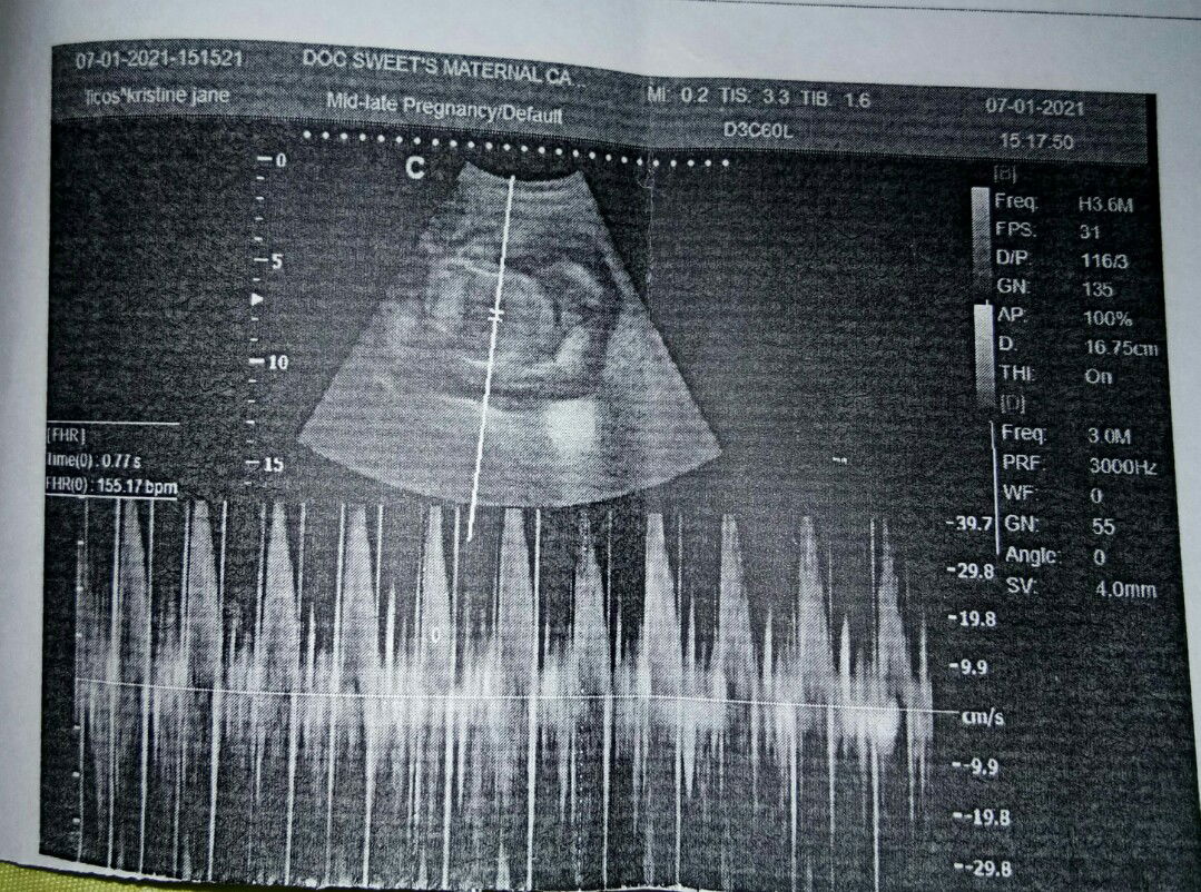 Kristine Jane B Licos profile icon