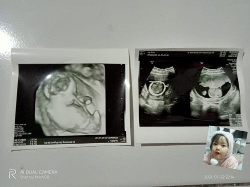 Dian Pramana Putri profile icon