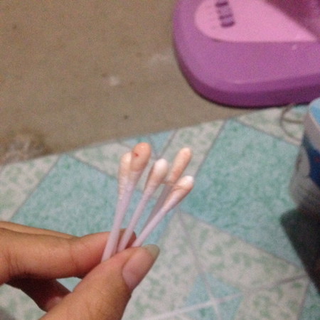 มูกเลือด