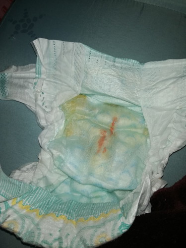 red stains in babies diaper