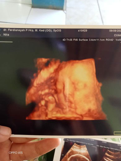 ernitaanwar profile icon