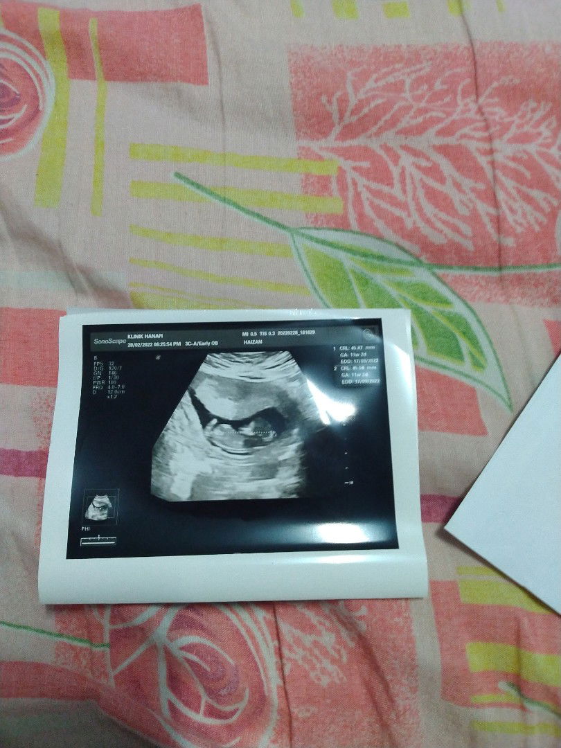 Nurul Haizan binti shaik mohideen profile icon