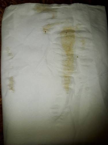 flek saat uk 30 minggu