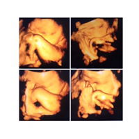 Restu Rahma Andriansari Siniwi profile icon