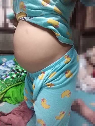 ท้องแรกคะ