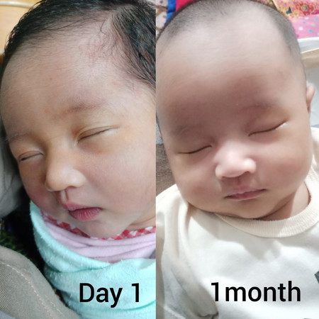 1month
