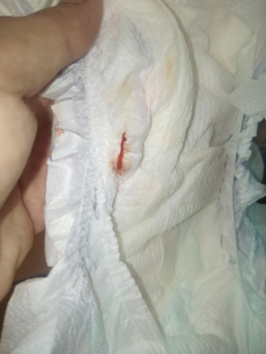 7days old si lo. answer po??