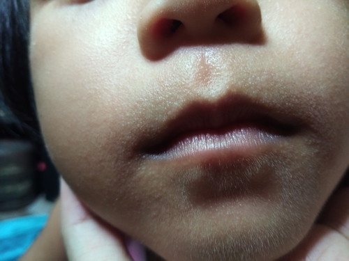 for baby