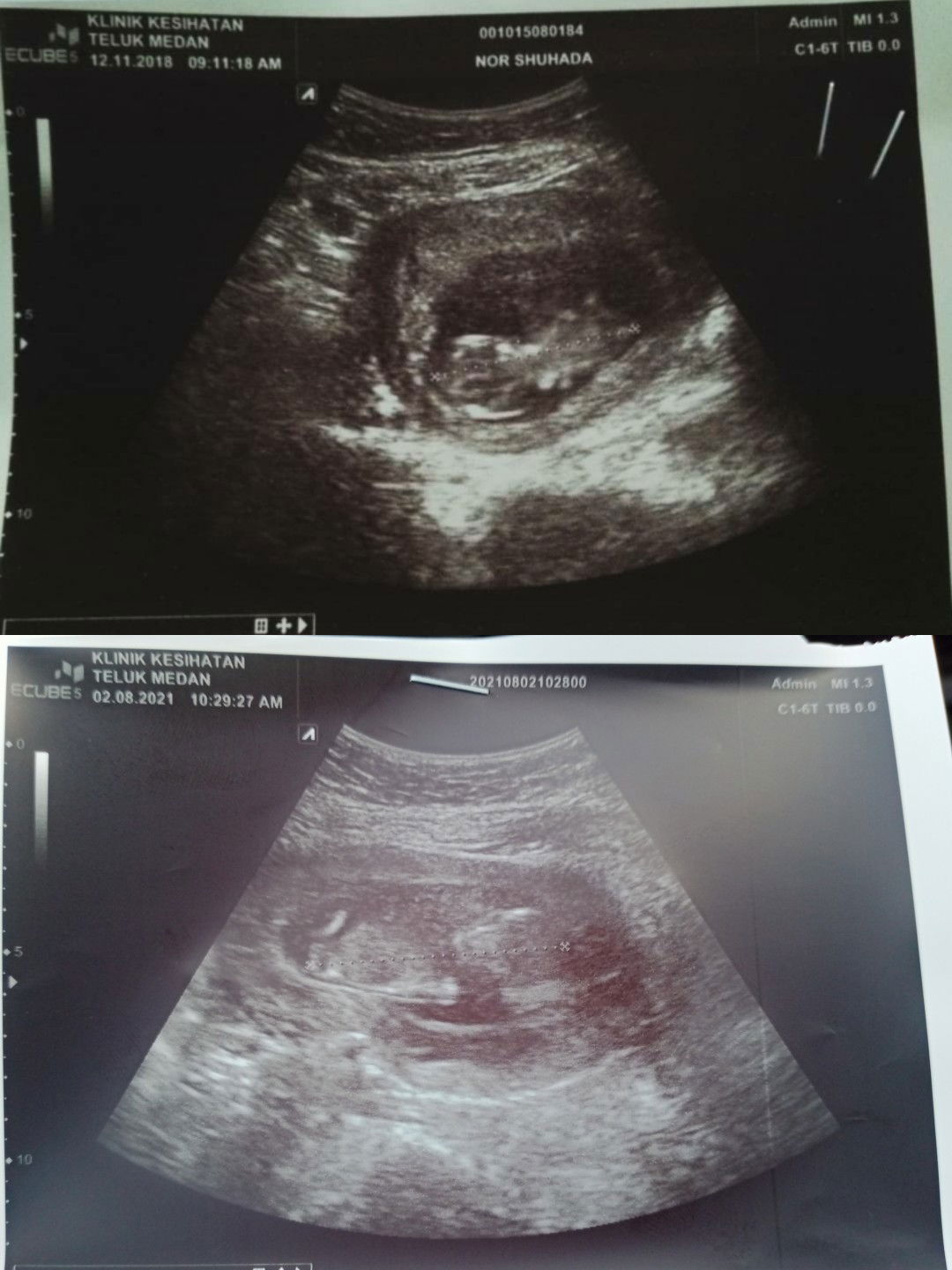 Norshuhada profile icon