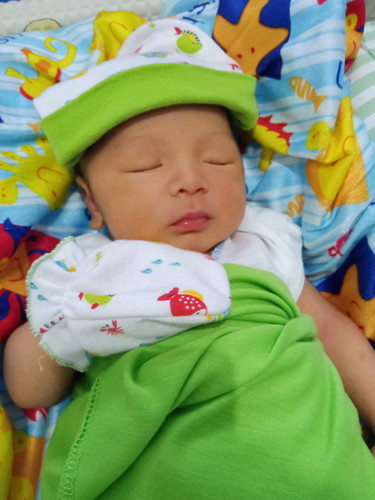 bayi kuning