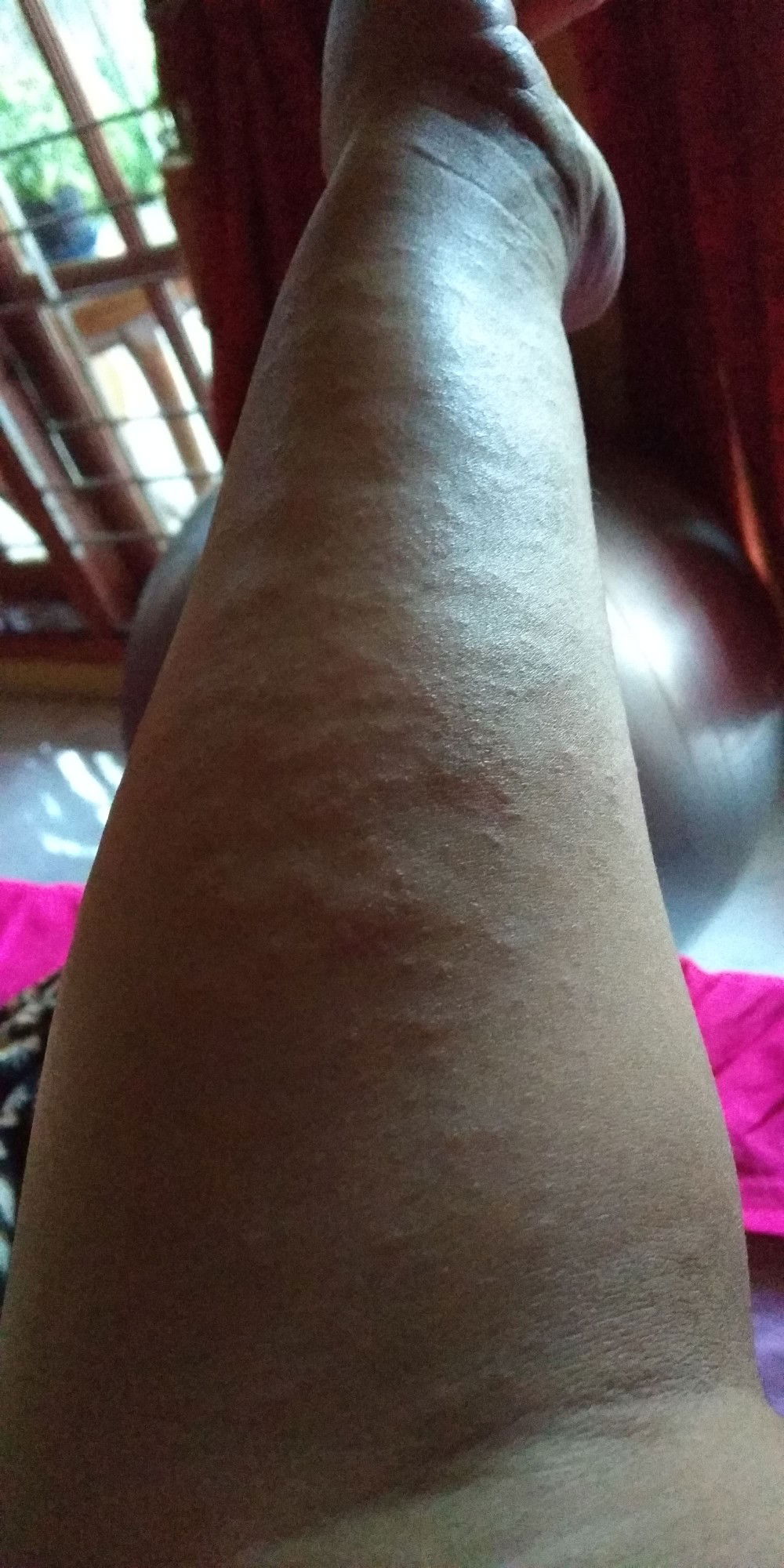 gatal2 saat usia kehamilan 37 weeks