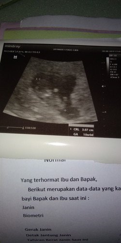 kehamilan