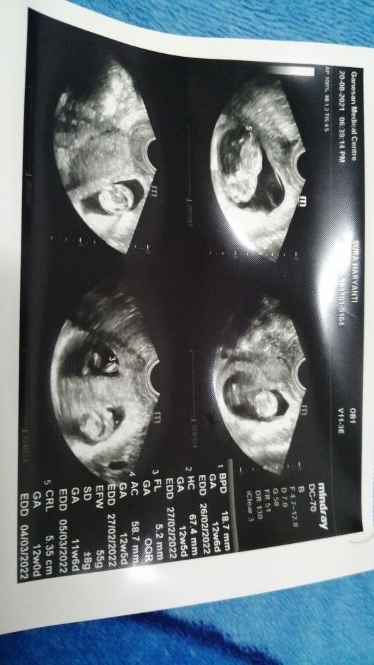 Sura Haryanti profile icon