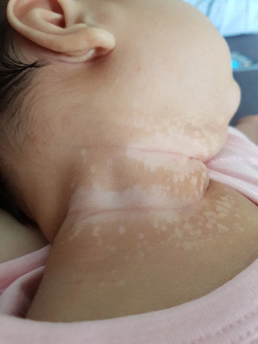 baby neck