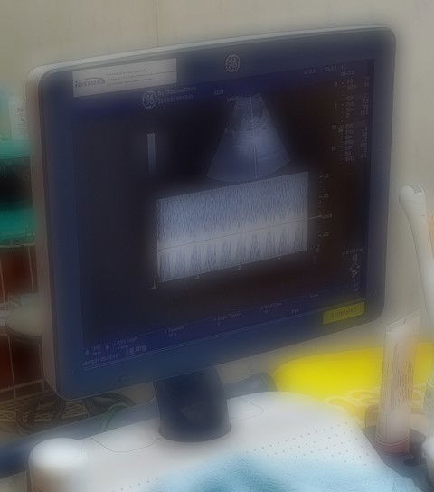 Sureemat. profile icon