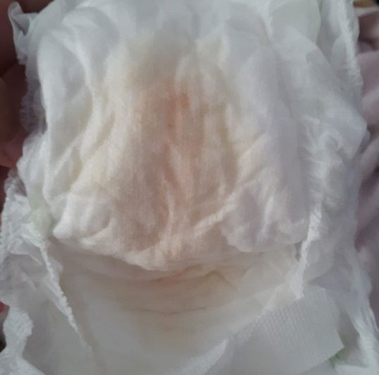 noda merah di diapers