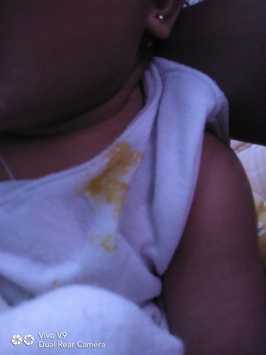 baby