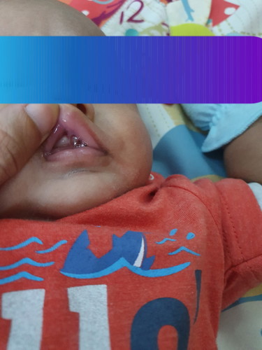 teething??