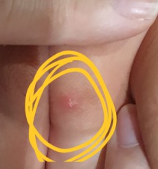 sore on vagina?