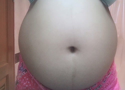 อยากเห็นท้องแม่ๆที่คลอด พฤศจิกา