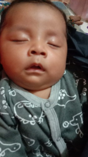 flu dn batuk byi 2 bulan