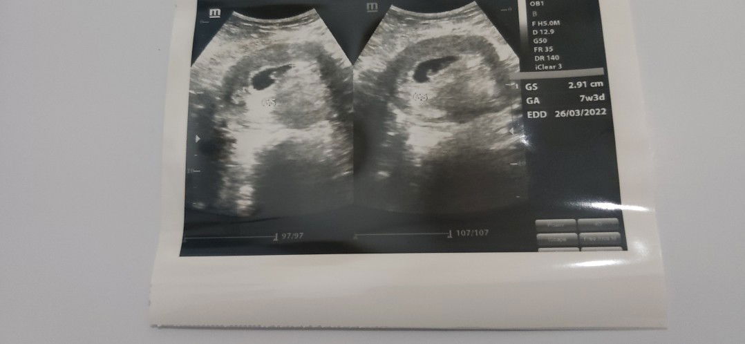 Rima Rahmalia Mulyasah profile icon