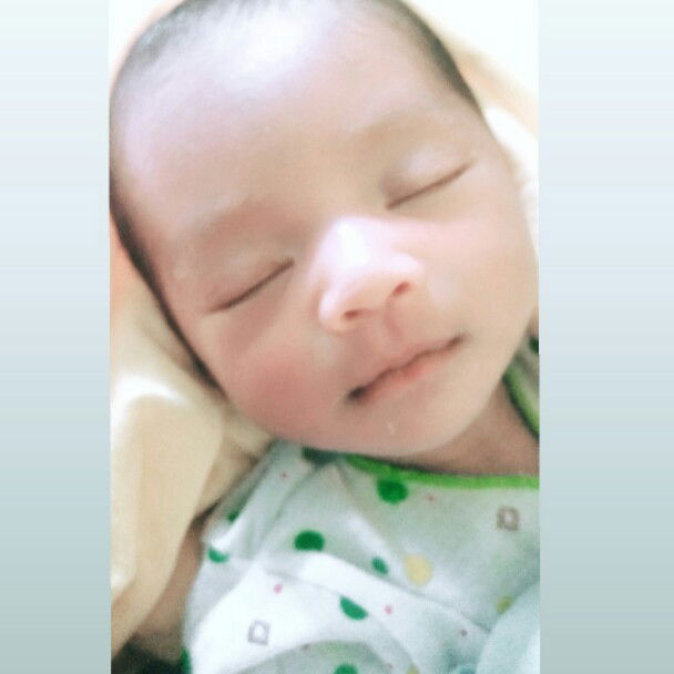 bayi umur dua minggu perut nya buncit