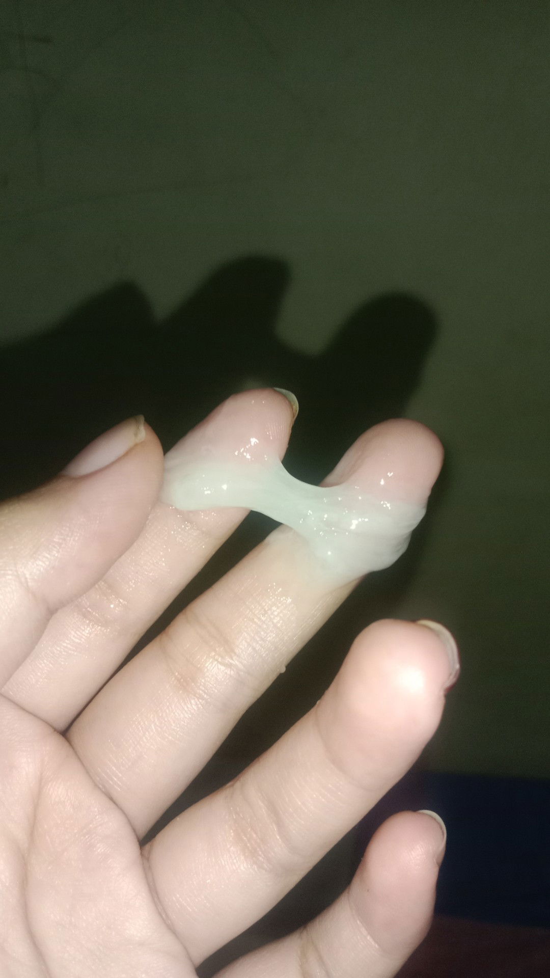 keputihan yng berlebih