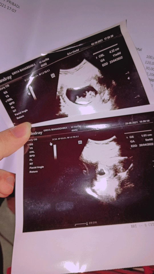 Vita Trnr profile icon