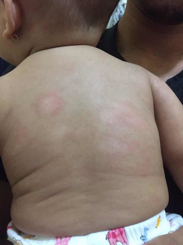 Kulit bayi