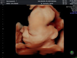 Herma Wanti profile icon