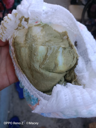 enfamil poop is this normal?