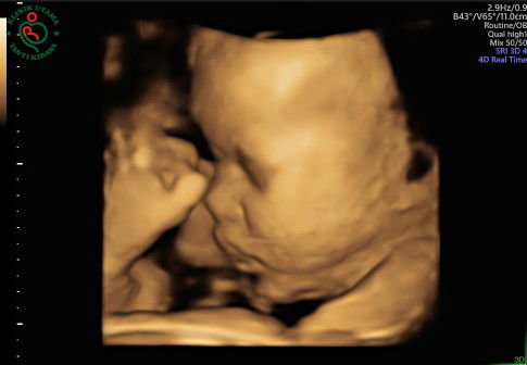 Tanita nimatullah profile icon