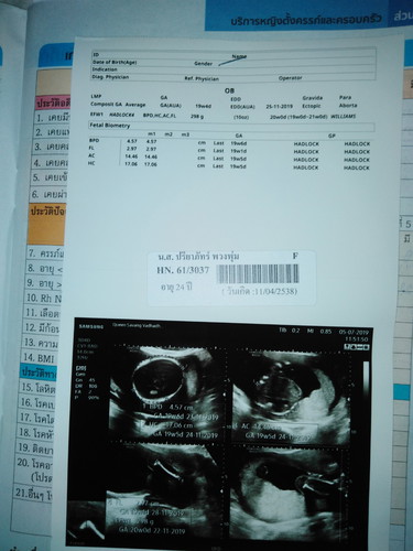 ได้ลูกสาวววคะ (คนแรกก)