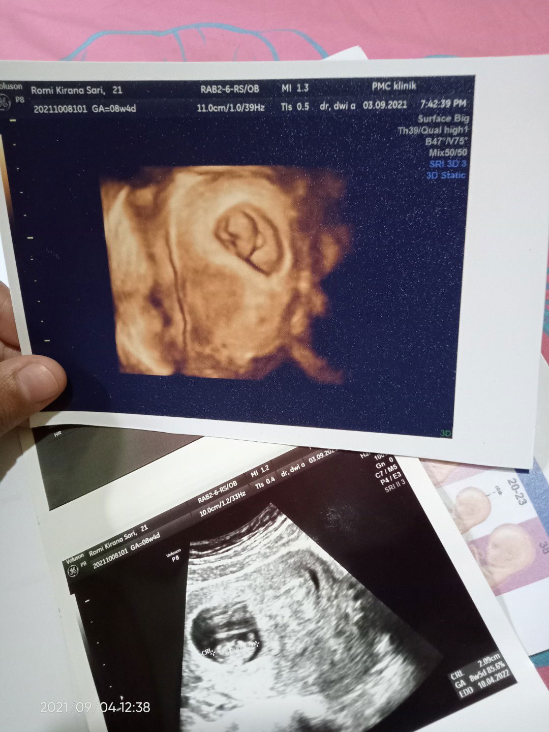 rommy kirana sari profile icon