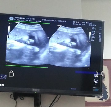 last ultrasound ang edd ko ay Dec 13,2019 ngaun nagpaultrasound ako for last trimester nov 28 na..