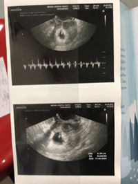 Pimvilai Sunghuad profile icon