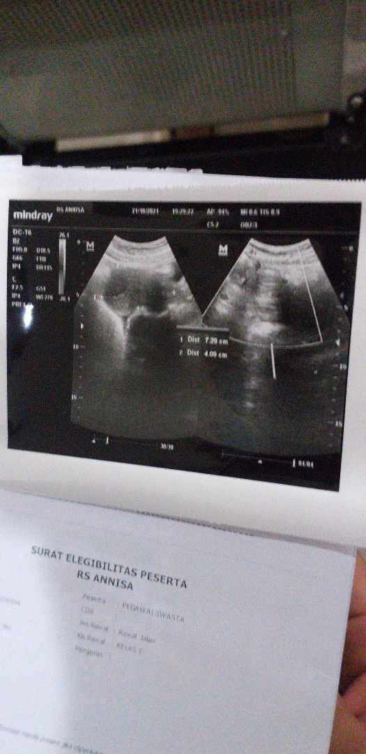 Rika Nurmayuni profile icon