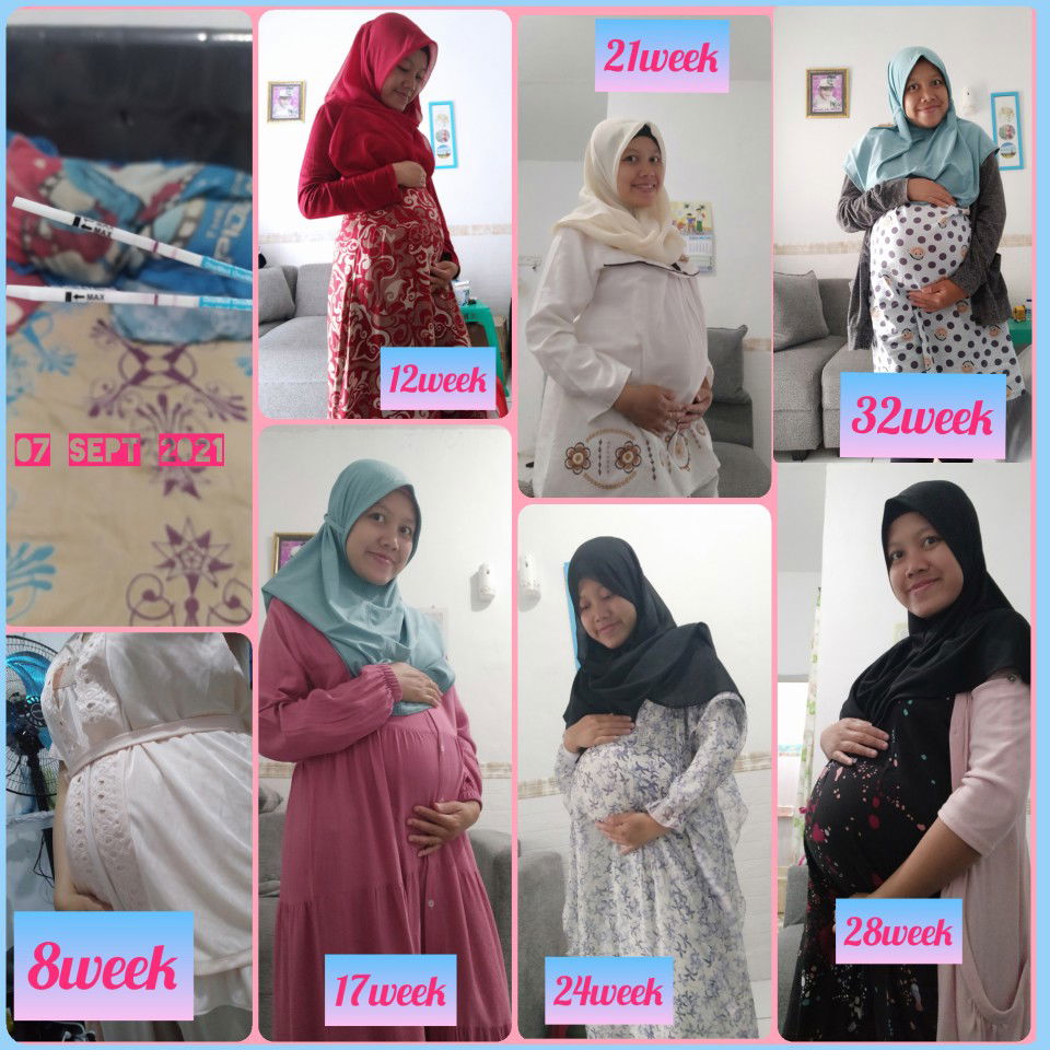 Ernie Dirgatiana profile icon