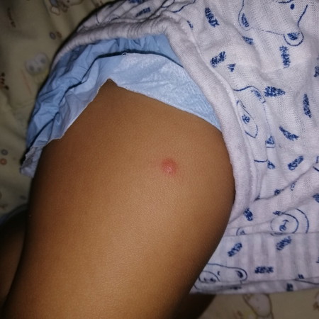 hello mamsh ask lang ako ano ointment