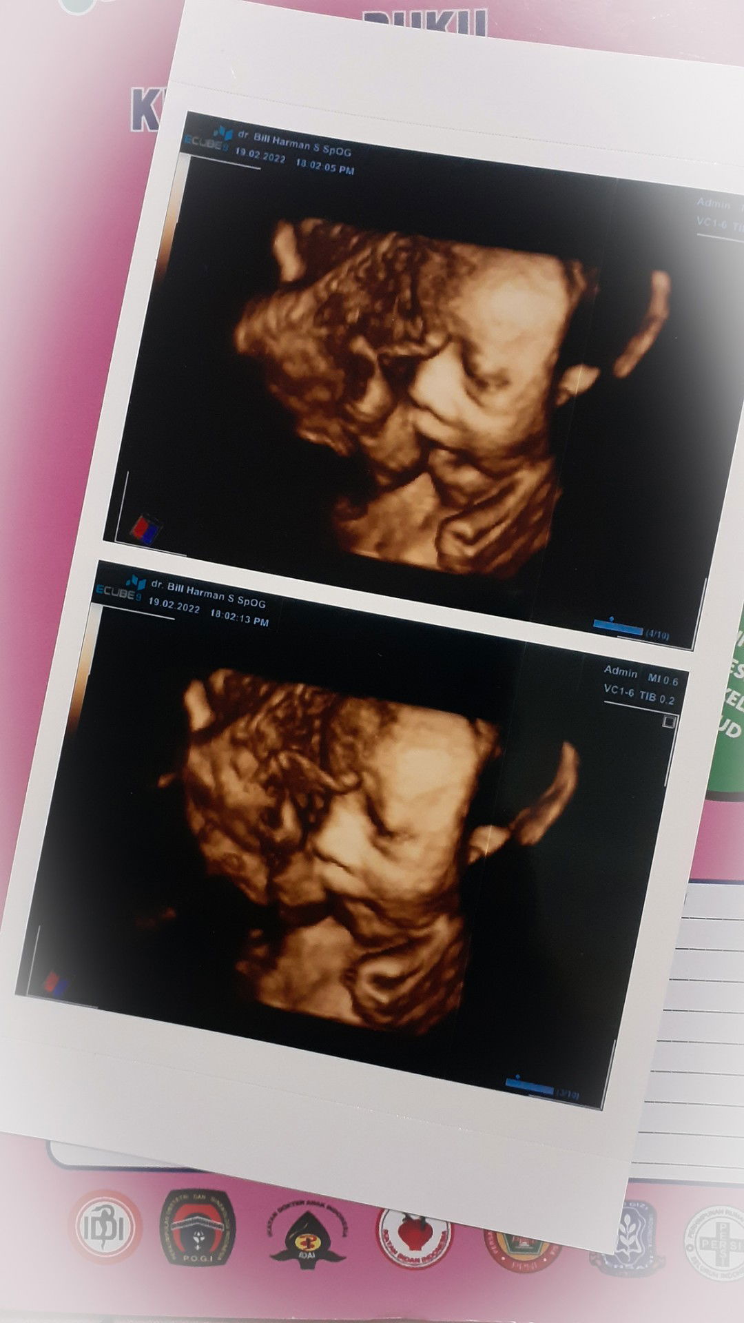 Dini Eka Wahyuni profile icon